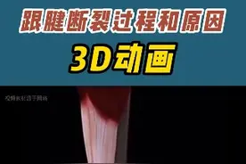带大家了解一下跟腱断裂的过程和原因#医学科普 #关注健康关注我 #3d动画演示视频封面