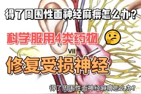 得了周围性面神经麻痹怎么办？科学服用4类药物，修复受损神经视频封面