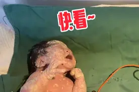 见过新生儿出生时身上有胎脂的，可没见过这么多的 #产房