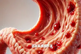 多司马酯立功！新研究：胃病患者常吃，可显著改善胃痛胃胀、反酸