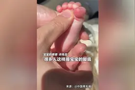 2 个月的宝宝在脚底按摩出现巴宾斯基反射，脚丫如同 “开花”