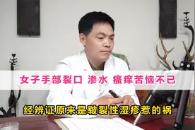 女子手部裂口、渗水、瘙痒，苦恼不已，原来是皲裂性湿疹惹的祸