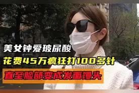 美女钟爱玻尿酸，花费45万疯狂打100多针，直至脸部变成发面馒头视频封面
