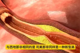 国产ED新药司美那非获批上市，五大优势，不可不知