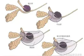 尿频、尿急、尿不尽、尿痛，中医怎么应对？图片