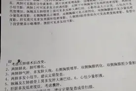 我父亲肺癌术后开始化疗的过程图片