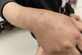 受伤后拍不拍X光检查一下，好像一直是比较有争议的问题！图片