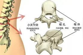 腰突的本质是能量淤堵，这4个靠谱方法，可解决至少80%的腰突图片