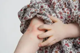 身体痒不一定是过敏！提醒：这2处发痒，当心是肾功能...图片