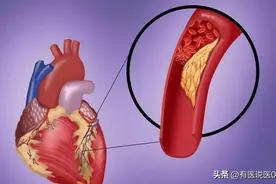 今天我们将为大家介绍治疗各种心脏病的10个“王牌”中成...图片