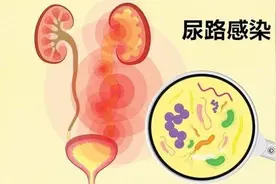 10个治疗尿路感染的中成药，建议收藏图片