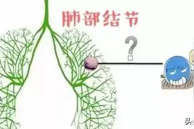 柏正平治肺结节 验方：桑白皮、桑叶、蜜枇杷叶、前胡...图片