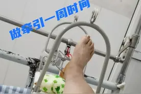 我的踝骨粉碎性骨折康复历程图片