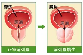 治前列腺炎摸爬滚打十多年的经验总结，千金不换图片