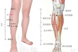 神奇的足三里穴位 【足三里】 1图片