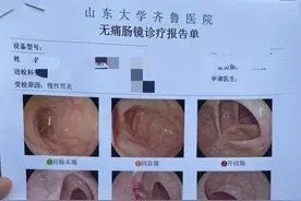 记录自己做肠胃镜的经历图片