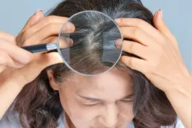 染头的人都看看吧图片