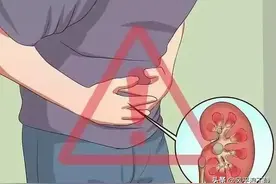 活蹦乱跳的我在去年7月份突然尿血，当时可把我给吓坏了图片