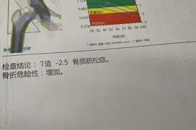 一天门诊确诊4例骨质疏松，均为50岁左右女性，为啥？图片