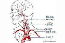 颈动脉发现斑块该怎么办？这4种食物要少碰！图片