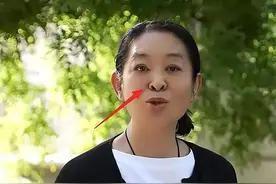 眼睛、鼻子、下巴都整了，还做过面部拉皮手术？倪萍回应了图片