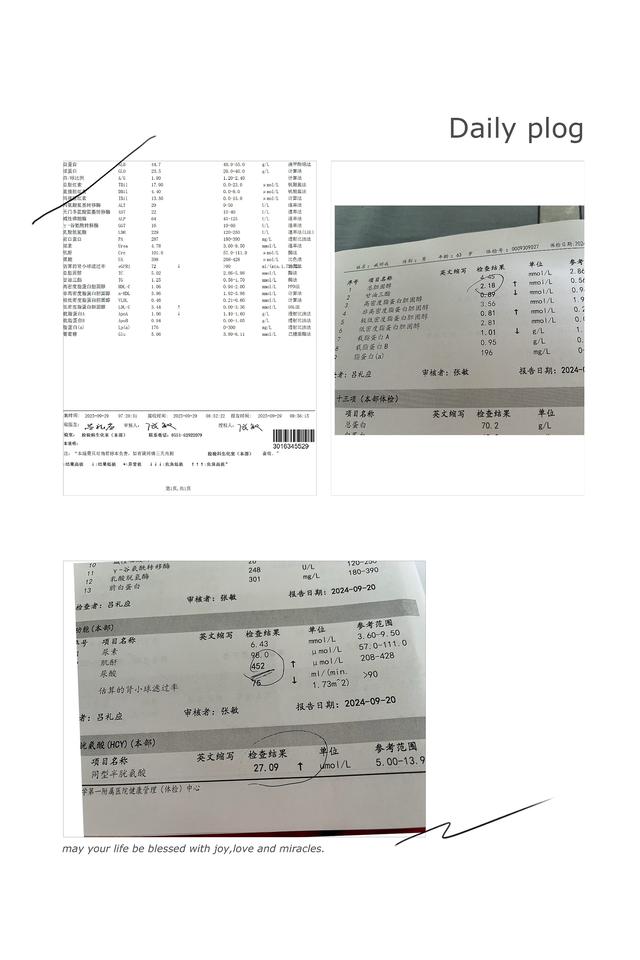 血脂异常你会选择哪种调理方式