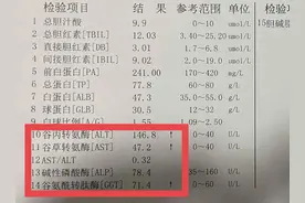 肝功能报告中的“4个酶“身世大揭秘！图片