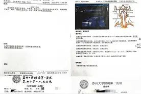 控诉苏州大学附属第一医院的庸医图片