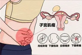 5厘米的子宫肌瘤，我用一方3个月把它消掉，患者大喜图片