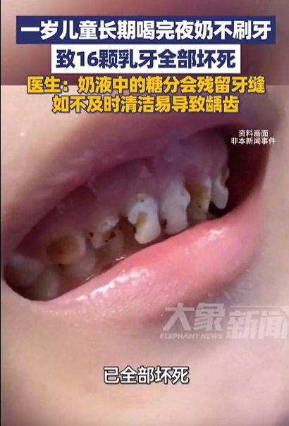 孩子喝夜奶后口腔需要清洁吗