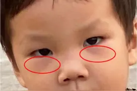 宝宝脾胃好不好，脸不会说谎图片