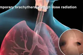 癌症是否会传染？ 癌症不会传染图片