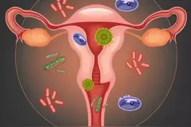 妇科疾病：阴道炎的常见症状 妇科疾病是女性常见的健...图片