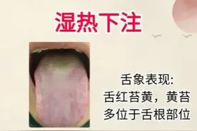 湿热下注、肝胆湿热、脾胃湿热，如何精准分辨与调理？图片