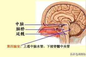 【科普】脑干梗死的临床表现与磁共振表现图片
