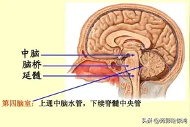 【科普】脑干梗死的临床表现与磁共振表现图片