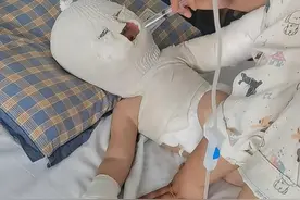 2岁孩子被妈妈用油烫的面目全非，爸爸自责，怎么不早回来10分钟图片