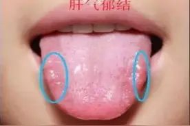 肝气郁结，吃逍遥丸、柴胡舒肝丸没用，这两个中成药能帮忙图片