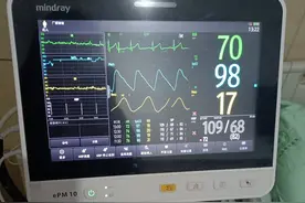 老爸二十多天没吃东西，医生说:我就死马给你当活马医吧图片