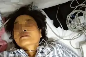 39岁女子瘫痪在床，大小便失禁，每天抽掉一包烟，还能活多久？图片