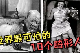 世界最可怕的10个畸形人！拥有两套身体器官的女性，你肯定没见过视频封面