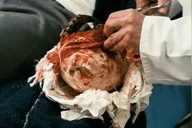 （2）男人的手突然变成了龙虾手悬疑科幻我的观影报告视频封面