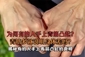 为何有的人手上青筋凸起？青筋多就说明身体差吗？