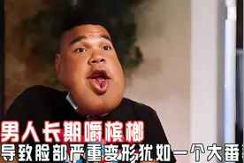 男人长期嚼槟榔，导致脸部严重变形犹如一个大番薯视频封面