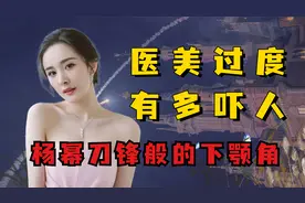 明星医美后遗症有多可怕？毛晓彤开屏暴击，金晨满脸僵硬藏不住视频封面