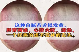 这种白腻苔舌根发黄，脾肾两虚，心肝火旺，湿热，一个经典的方视频封面