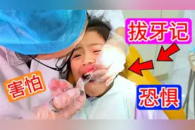 心心今天去拔牙了，过程太惊险了，打麻药，老虎钳，我看着都怕。