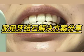 告别口臭烦恼，家用牙结石解决方案分享！