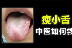舌头小、舌前鼓胀，究竟是身体出了什么问题？医生一次给你讲明白视频封面