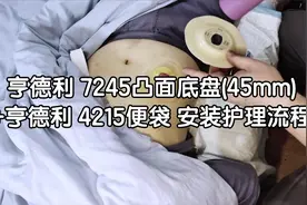 肠造口袋安装流程 亨德利7245凸面底盘+亨德利4215便袋安装方法视频封面